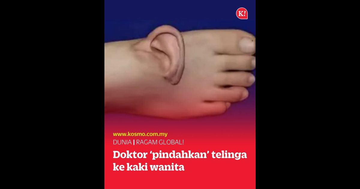 Doktor ‘pindahkan’ telinga ke kaki wanita