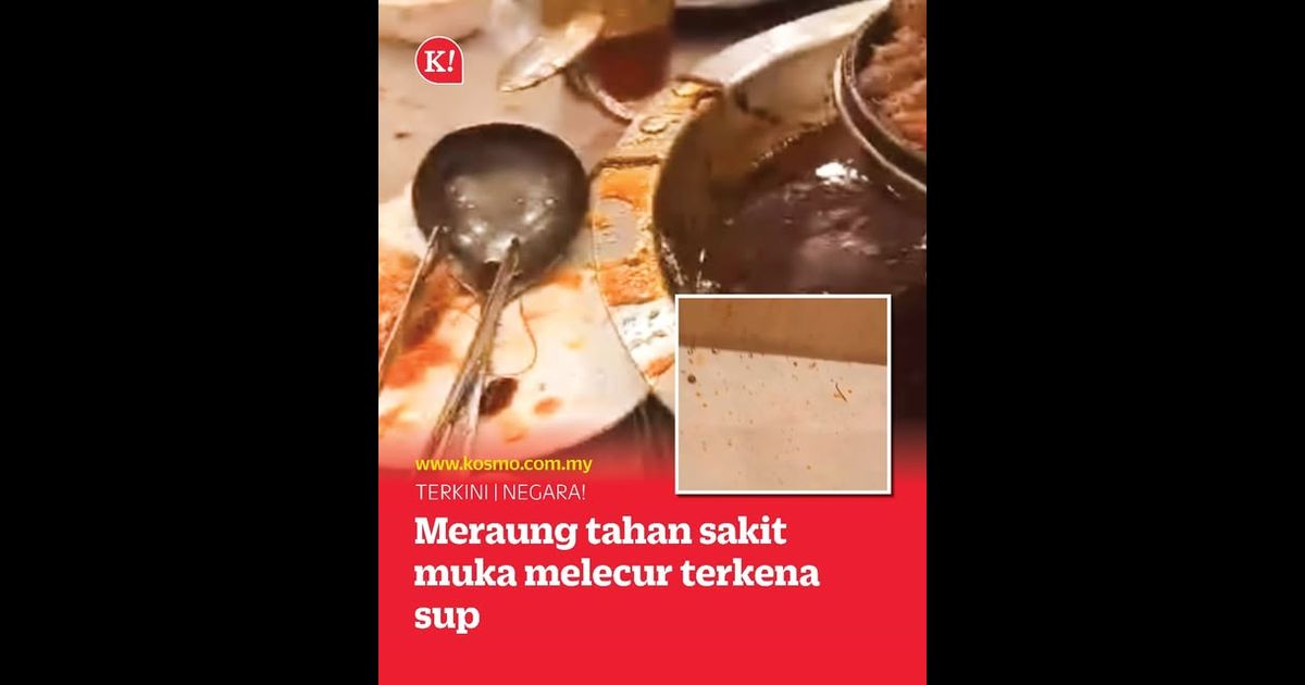 Meraung tahan sakit muka melecur terkena sup