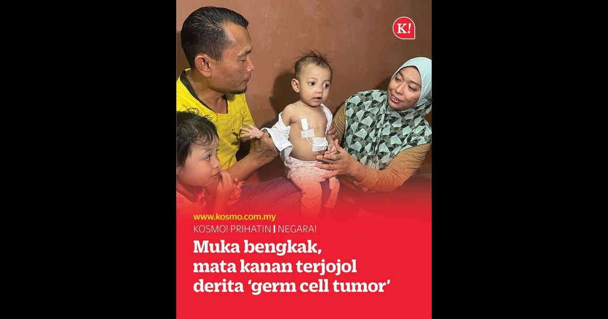Muka bengkak, mata kanan terjojol derita ‘germ cell tumor’