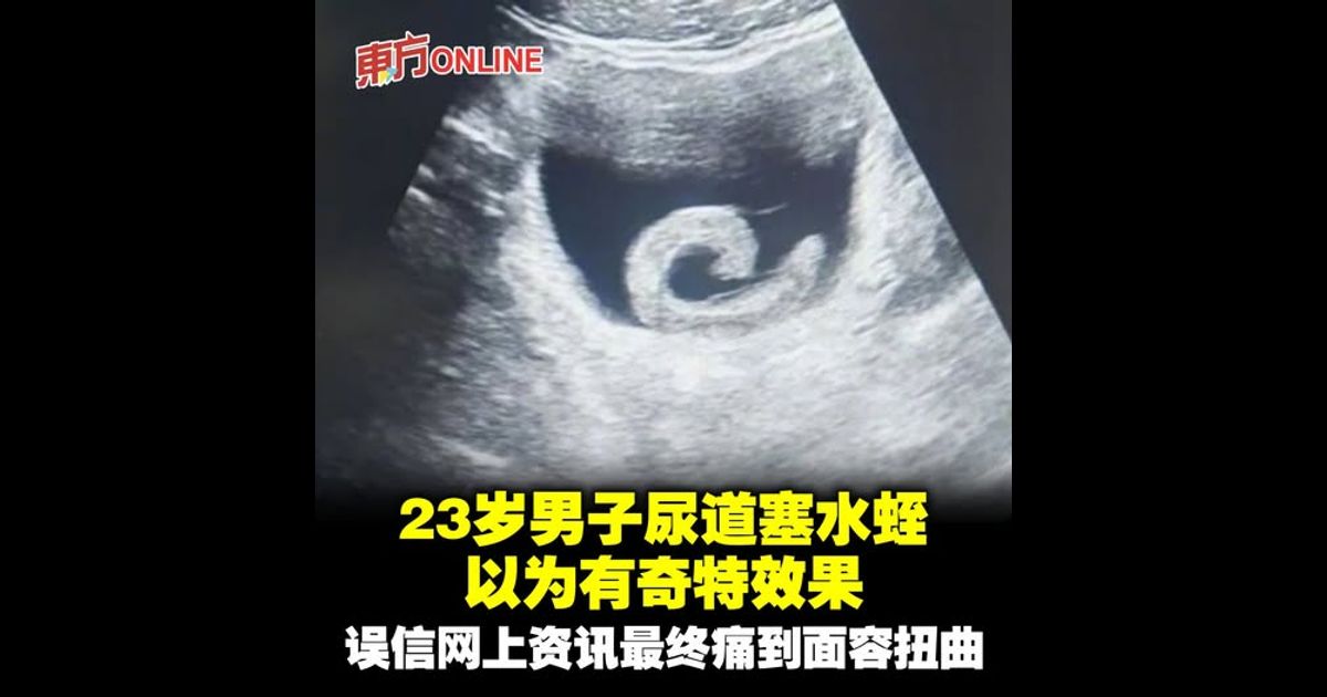 23岁男子尿道塞水蛭以为有奇特效果　误信网上资讯最终痛到面容扭曲