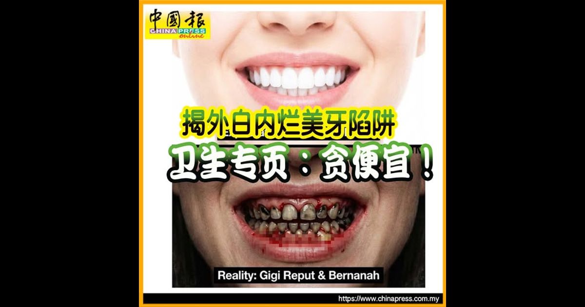 揭外白内烂美牙陷阱 卫生专页:贪便宜!|附音频