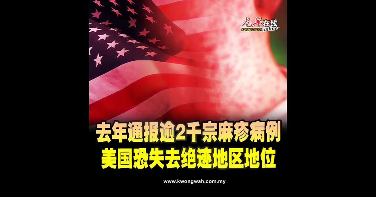 去年通报逾2千宗麻疹病例 美国恐失去绝迹地区地位
